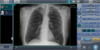 A screen capture of a chest image on CS7