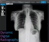 xray_that_moves2